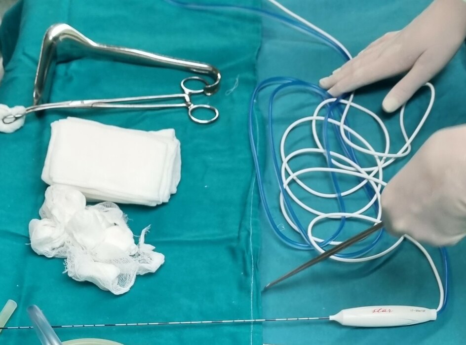 transplatacija pluca, k-013, vesti srbija